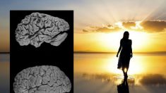 L’Alzheimer dimostra che l’anima non esiste?