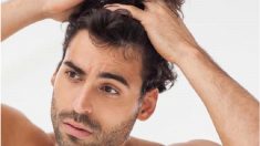 Segreti per capelli sani: 5 cause della calvizie e canizie precoce