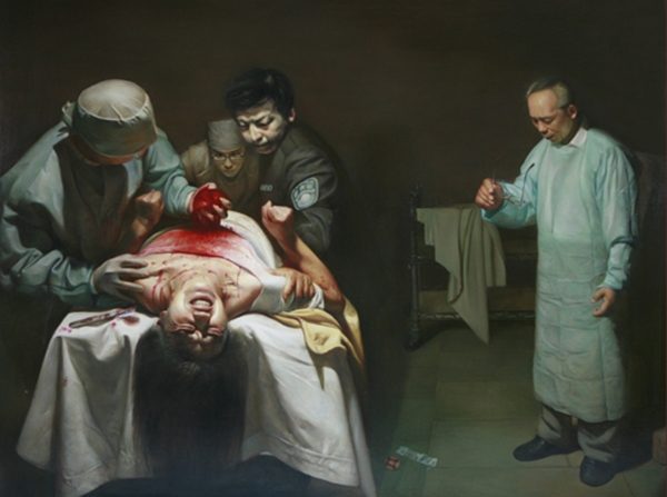 Dipinto a olio dell'artista Xiqiang Dong raffigurante il prelievo forzato di organi in vita, inflitto a un praticante della Falun Dafa in Cina. (gentile concessione di Xiqiang Dong).
