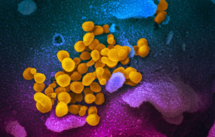 Immagine al microscopio elettronico a scansione, del Sars-CoV-2 (in giallo), il virus che causa il Covid-19, che emerge dalla superficie delle cellule (blu/rosa) coltivate in laboratorio (per gentile concessione del NIAID-RML).