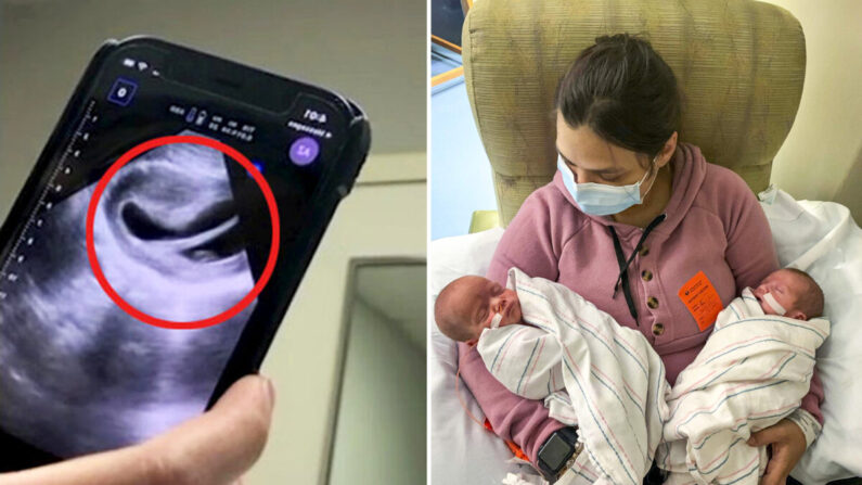 Mamma con utero a forma di cuore partorisce due gemelli