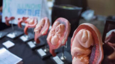 Aborto tardivo: Un complicato dibattito morale in America e nel mondo