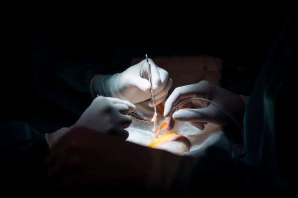 Dottori in preparazione per un trapianto di rene. (Pierre-Philippe Marcou/Afp/Getty Images)