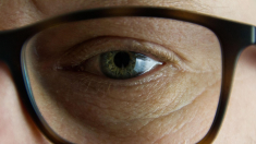 Nuova frontiera nella chirurgia oculare, cornea rimodellata senza laser