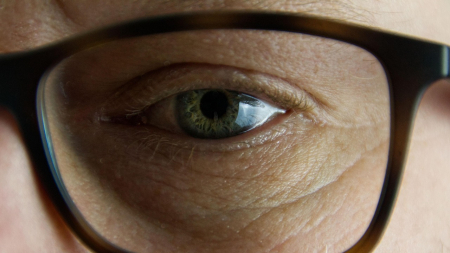 Nuova frontiera nella chirurgia oculare, cornea rimodellata senza laser