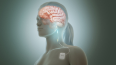 Un’innovativa strategia per combattere stress e infiammazione